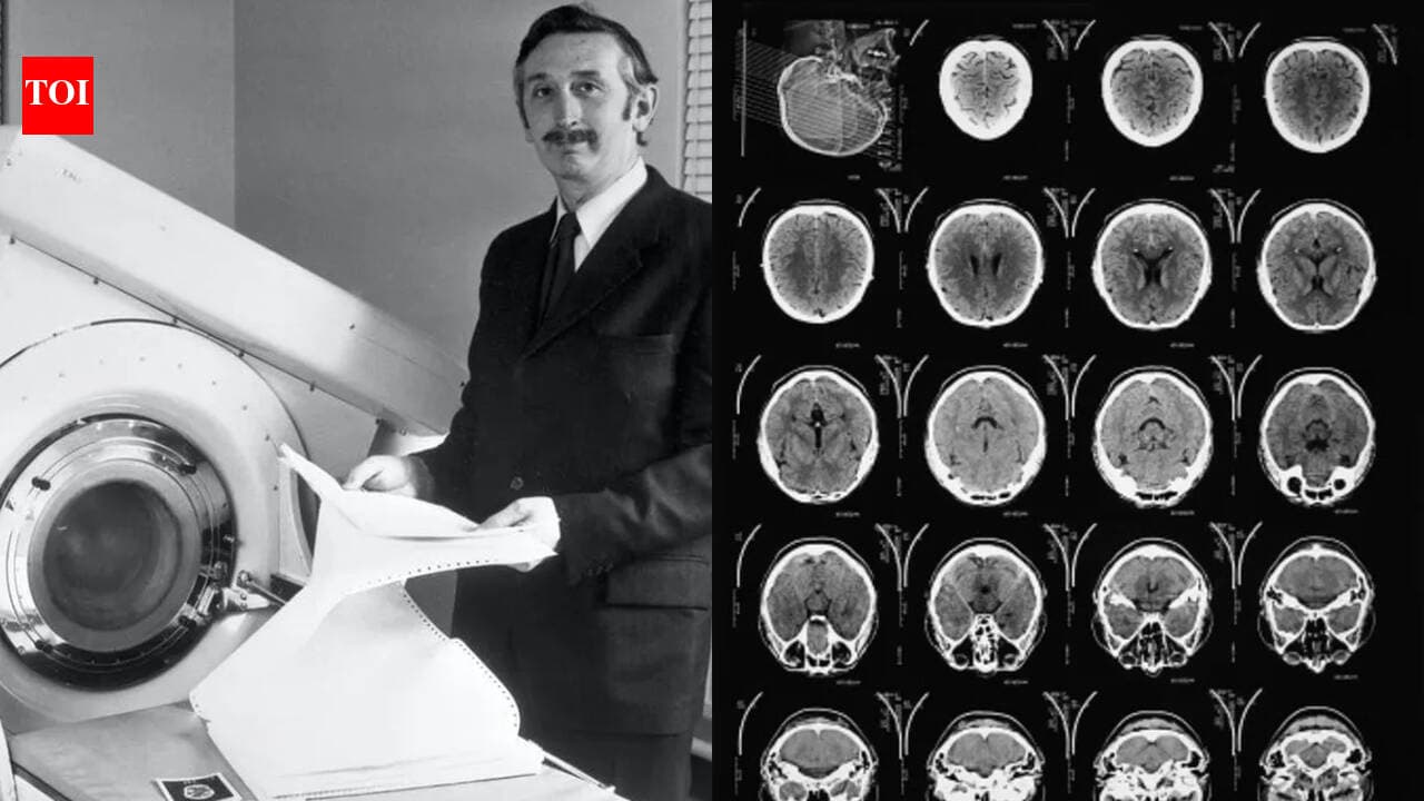 In 1971, engineer Godfrey Hounsfield’s new scanner revealed a brain cyst in the first clinical CT scan; 8 years later, he shared the Nobel Prize for developing computer-assisted tomography